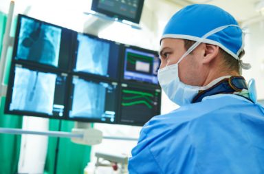 angioplasty