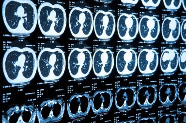 MRI tomogram of human brain